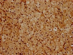 Invitrogen PSMC6 Polyclonal Antibody 100 &mu;g; Unconjugated:Antibodies,