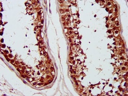 Invitrogen PSMC6 Polyclonal Antibody 100 &mu;g; Unconjugated:Antibodies,