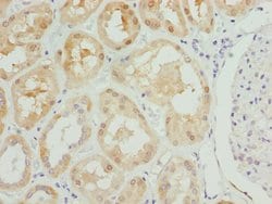 Invitrogen PSPH Polyclonal Antibody 100 &mu;L; Unconjugated:Antibodies,