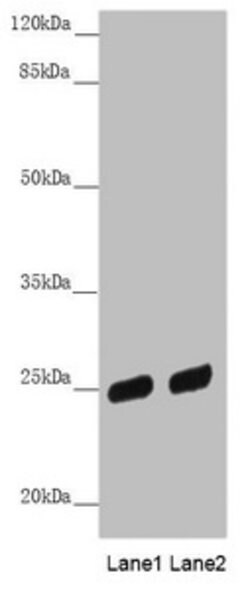 Invitrogen PSPH Polyclonal Antibody 100 &mu;L; Unconjugated:Antibodies,