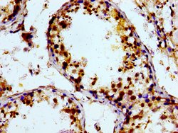 Invitrogen PTGR2 Polyclonal Antibody 100 &mu;g; Unconjugated:Antibodies,
