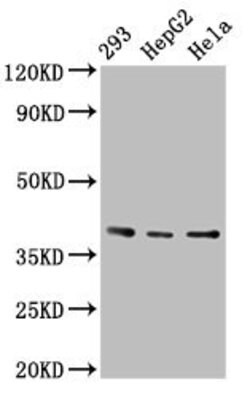 Invitrogen PTGR2 Polyclonal Antibody 100 &mu;g; Unconjugated:Antibodies,