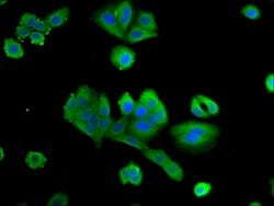 Invitrogen PTX3 Polyclonal Antibody 100 &mu;g; Unconjugated:Antibodies,