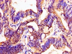 Invitrogen PTX3 Polyclonal Antibody 100 &mu;g; Unconjugated:Antibodies,
