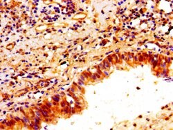 Invitrogen PTX3 Polyclonal Antibody 100 &mu;g; Unconjugated:Antibodies,
