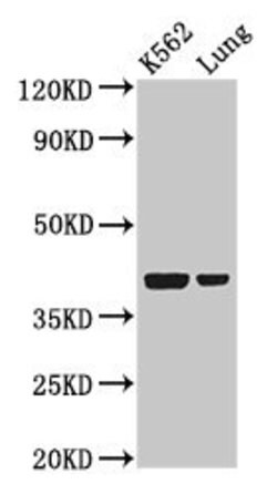 Invitrogen PTX3 Polyclonal Antibody 100 &mu;g; Unconjugated:Antibodies,