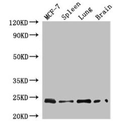 Invitrogen RAB25 Polyclonal Antibody 100 &mu;g; Unconjugated:Antibodies,
