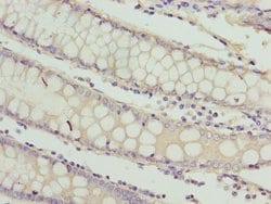 Invitrogen RAB3B Polyclonal Antibody 100 &mu;g; Unconjugated:Antibodies,
