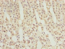 Invitrogen RAB9 Polyclonal Antibody 100 &mu;L | Buy Online | Invitrogen&trade; | Fisher Scientific