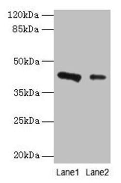 Invitrogen RAD23B Polyclonal Antibody 100 &mu;g; Unconjugated:Antibodies,