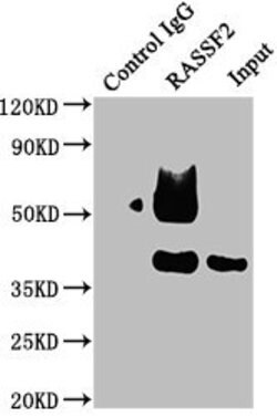 RASSF2 Polyclonal Antibody:Antibodies, Polyclonal
