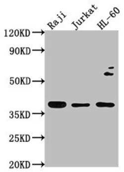 RASSF2 Polyclonal Antibody:Antibodies, Polyclonal