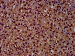Invitrogen RECQ4 Polyclonal Antibody 100 &mu;g | Buy Online | Invitrogen&trade; | Fisher Scientific