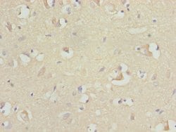 Invitrogen RFPL2 Polyclonal Antibody 100 &mu;L; Unconjugated:Antibodies,