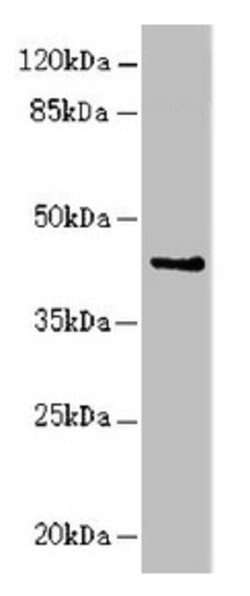 RFPL2 Polyclonal Antibody:Antibodies, Polyclonal