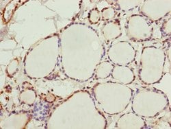 Invitrogen ZNF313 Polyclonal Antibody 100 &mu;L; Unconjugated:Antibodies,