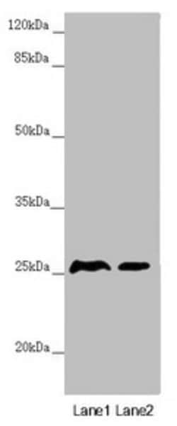 Invitrogen ZNF313 Polyclonal Antibody 100 &mu;L; Unconjugated:Antibodies,