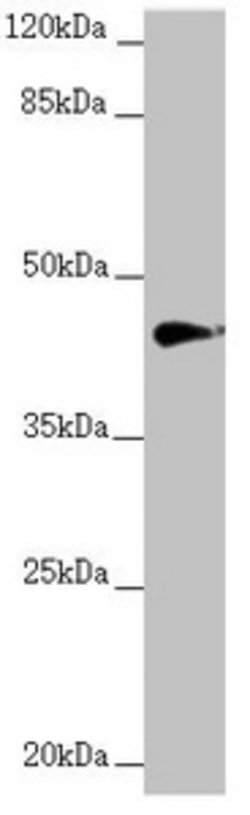 Invitrogen RNF13 Polyclonal Antibody 100 &mu;L; Unconjugated:Antibodies,