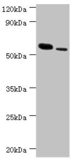 Invitrogen RNF8 Polyclonal Antibody 100 &mu;L; Unconjugated:Antibodies,