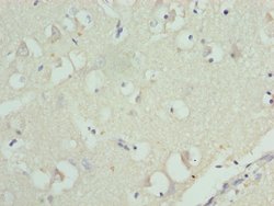 Invitrogen RPL9 Polyclonal Antibody 100 &mu;L; Unconjugated:Antibodies,