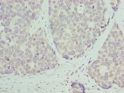 Invitrogen RPL9 Polyclonal Antibody 100 &mu;L; Unconjugated:Antibodies,