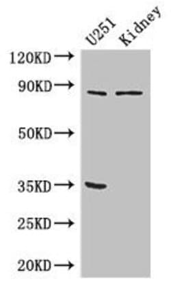 Invitrogen MSK2 Polyclonal Antibody 100 &mu;g; Unconjugated:Antibodies,