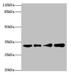 Invitrogen RSU1 Polyclonal Antibody 100 &mu;g; Unconjugated:Antibodies,