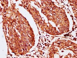 Invitrogen SERPINB2 Polyclonal Antibody 100 &mu;g; Unconjugated:Antibodies,