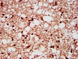 Invitrogen SF3B1 Polyclonal Antibody 100 &mu;g; Unconjugated:Antibodies,