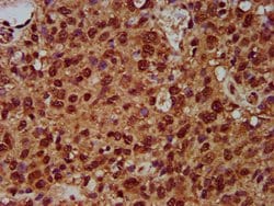 Invitrogen SF3B1 Polyclonal Antibody 100 &mu;g; Unconjugated:Antibodies,