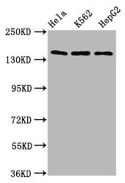 Invitrogen SF3B1 Polyclonal Antibody 100 &mu;g; Unconjugated:Antibodies,