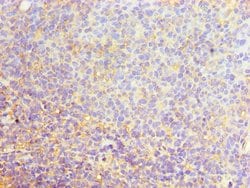 Invitrogen SRSF4 Polyclonal Antibody 100 &mu;L; Unconjugated:Antibodies,