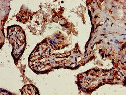 Invitrogen SnoN Polyclonal Antibody 100 &mu;g | Buy Online | Invitrogen&trade; | Fisher Scientific