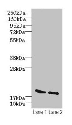 Invitrogen SKP1 Polyclonal Antibody 100 &mu;g; Unconjugated:Antibodies,