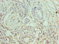 Invitrogen CRACC Polyclonal Antibody 100 &mu;L; Unconjugated:Antibodies,