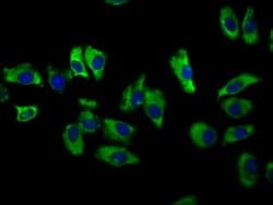 Invitrogen&trade;&nbsp;NKCC1 Polyclonal Antibody