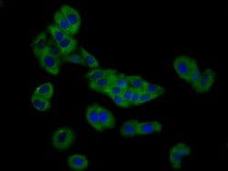 Invitrogen SLC26A4 Polyclonal Antibody 100 &mu;g; Unconjugated:Antibodies,