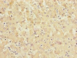 Invitrogen SLC6A12 Polyclonal Antibody 100 &mu;L; Unconjugated:Antibodies,