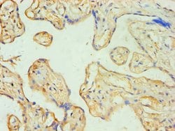 Invitrogen SOAT1 Polyclonal Antibody 100 &mu;L; Unconjugated:Antibodies,