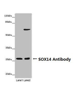 Invitrogen SOX14 Polyclonal Antibody 100 &mu;g; Unconjugated:Antibodies,