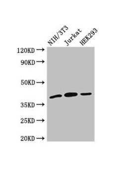 Invitrogen SPRY2 Polyclonal Antibody 100 &mu;g | Buy Online | Invitrogen&trade; | Fisher Scientific