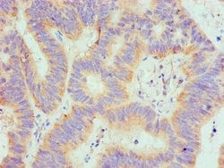 Invitrogen SPTLC1 Polyclonal Antibody 100 &mu;L; Unconjugated:Antibodies,