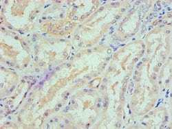 Invitrogen SPTLC1 Polyclonal Antibody 100 &mu;L; Unconjugated:Antibodies,