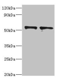 Invitrogen SPTLC1 Polyclonal Antibody 100 &mu;L; Unconjugated:Antibodies,