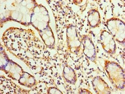 Invitrogen Sorcin Polyclonal Antibody 100 &mu;L; Unconjugated:Antibodies,