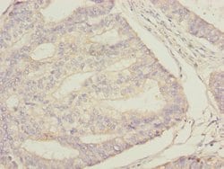Invitrogen STAM2 Polyclonal Antibody 100 &mu;L; Unconjugated:Antibodies,
