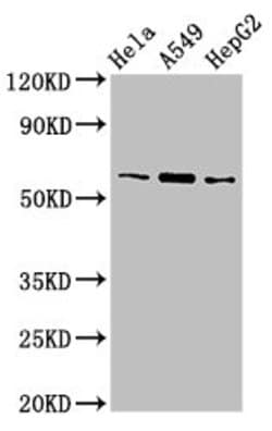 Invitrogen TBL1X Polyclonal Antibody 100 &mu;g | Buy Online | Invitrogen&trade; | Fisher Scientific