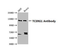 Invitrogen CA150 Polyclonal Antibody 100 &mu;g | Buy Online | Invitrogen&trade; | Fisher Scientific
