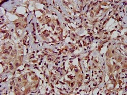 Invitrogen TFB1M Polyclonal Antibody 100 &mu;g; Unconjugated:Antibodies,