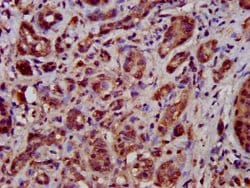 Invitrogen TFB1M Polyclonal Antibody 100 &mu;g; Unconjugated:Antibodies,